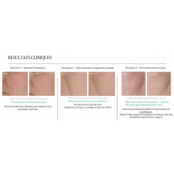 LightinDerm programme Skin Perfect
